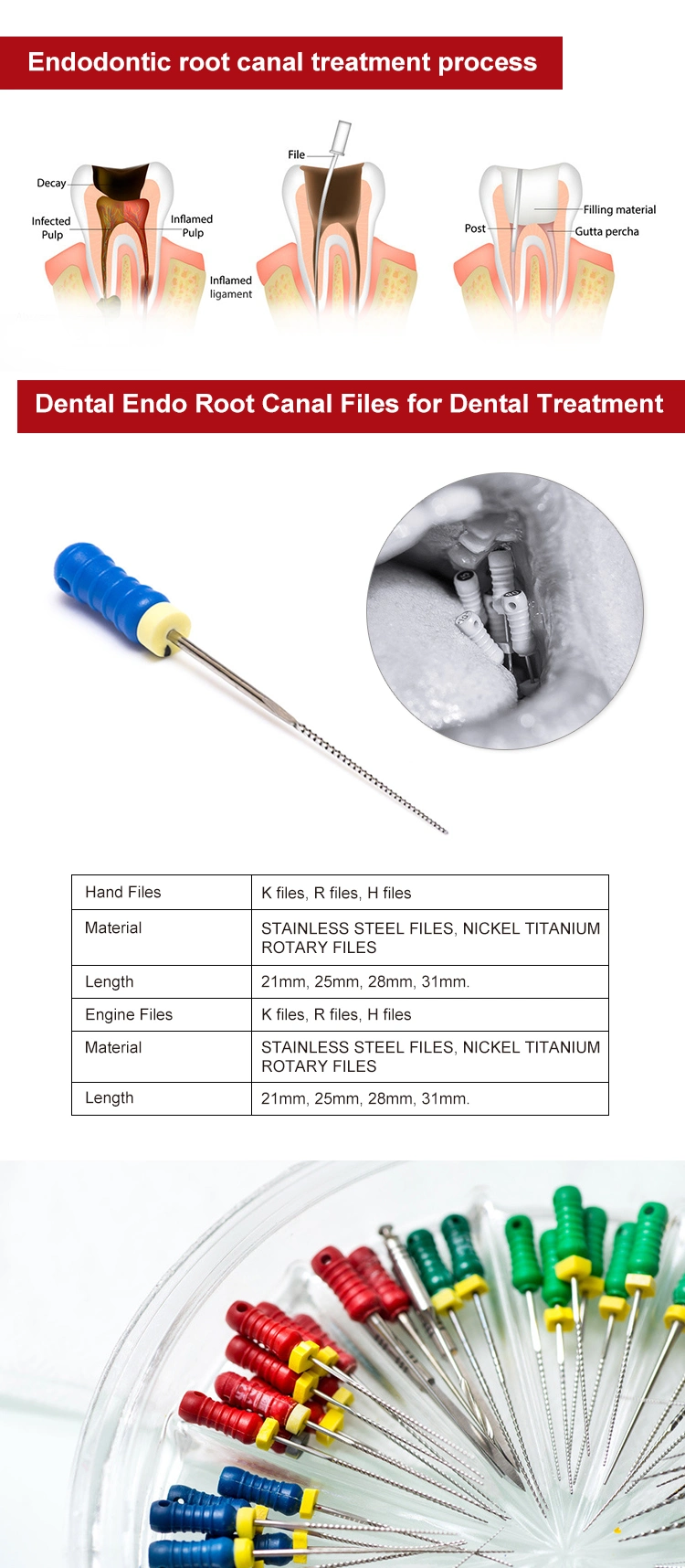 Dental Stainless Steel Root Canal Plugger Spreader File